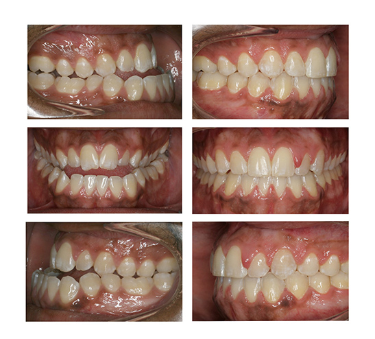 surgical orthodontics